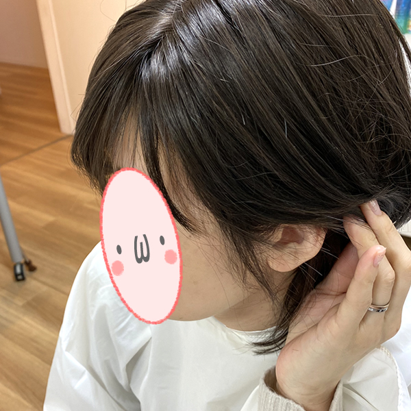ストーリーの医療用ウィッグはすべてのスタイルの生え際〜サイドにおくれ毛カットを施しています