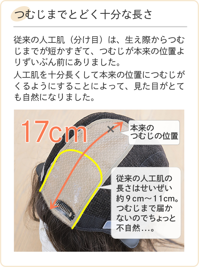 人工皮膚で業界最長の17センチの人工肌を採用