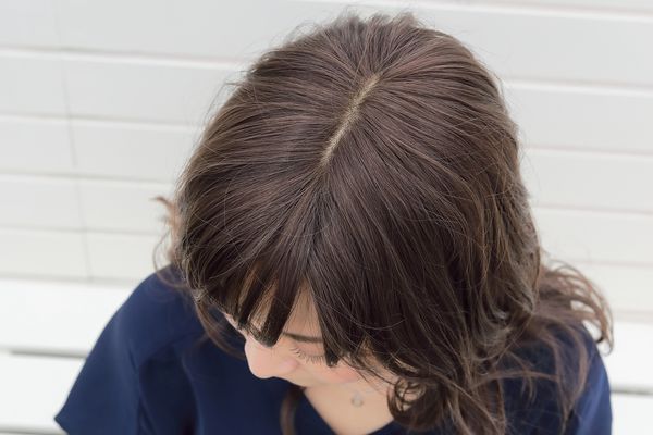 医療用ウィッグのつむじ・分け目はここをチェック