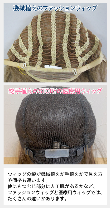 ほとんどの医療用ウィッグの植毛方法は手植えで、つむじと分け目部分には人工肌