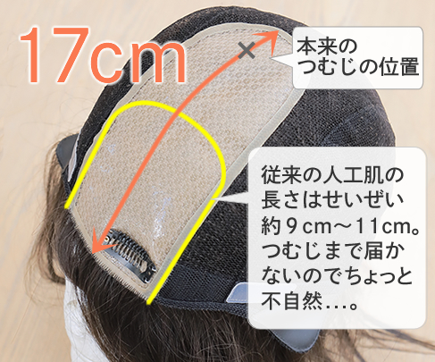 ストーリーのウィッグの人工肌は本来のつむじ位置までカバーするロング人工肌