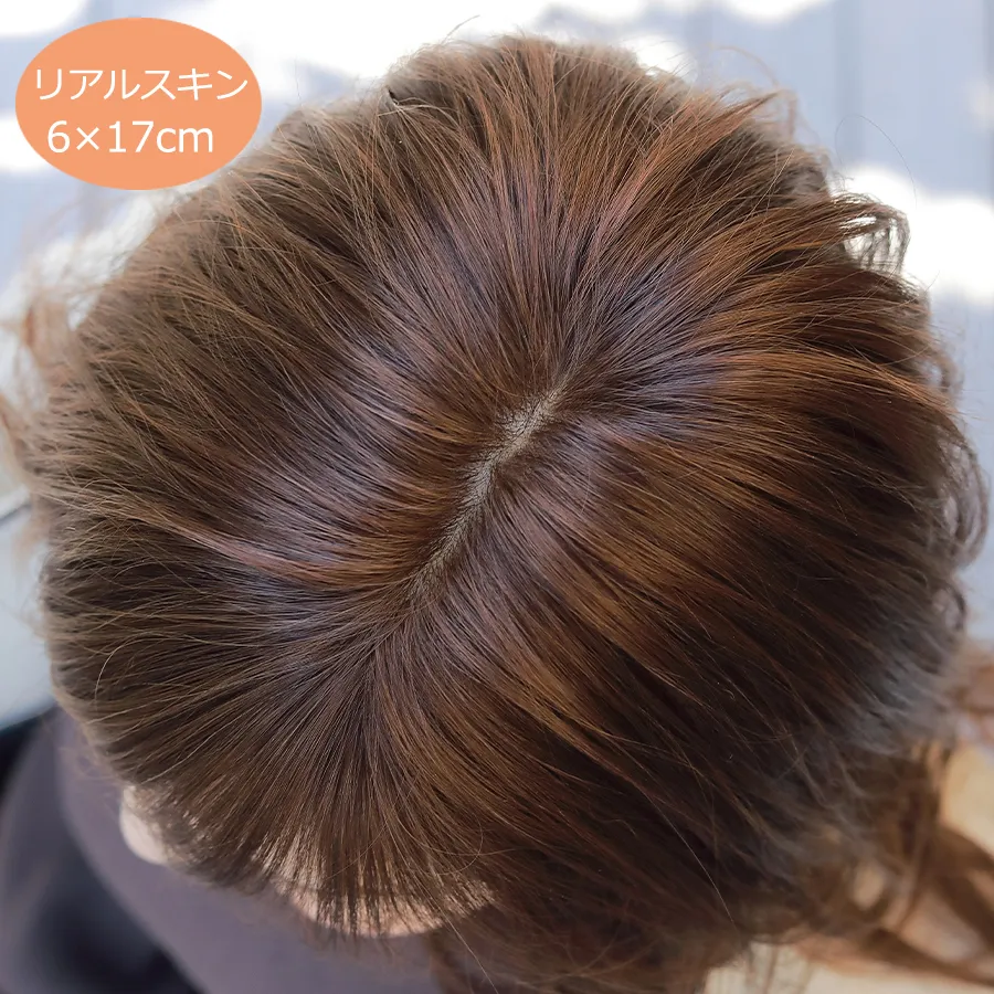 医療用ウィッグストーリー/リアルスキン