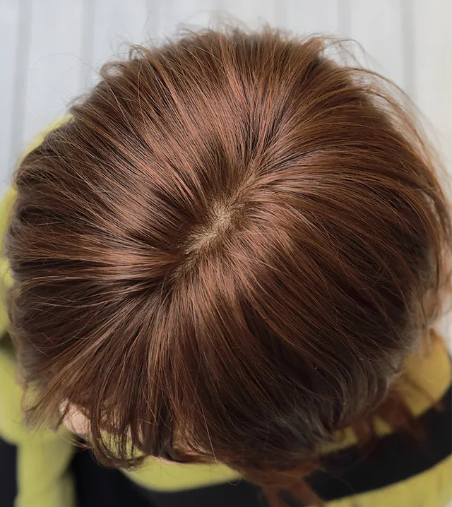 C[~fB̂ނAbvB̎RȕڂƐlHXLňŜ×pEBbO