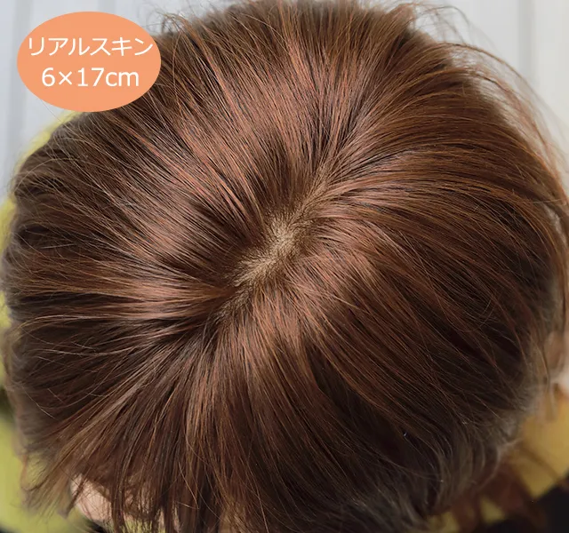 医療用ウィッグストーリー/リアルスキン