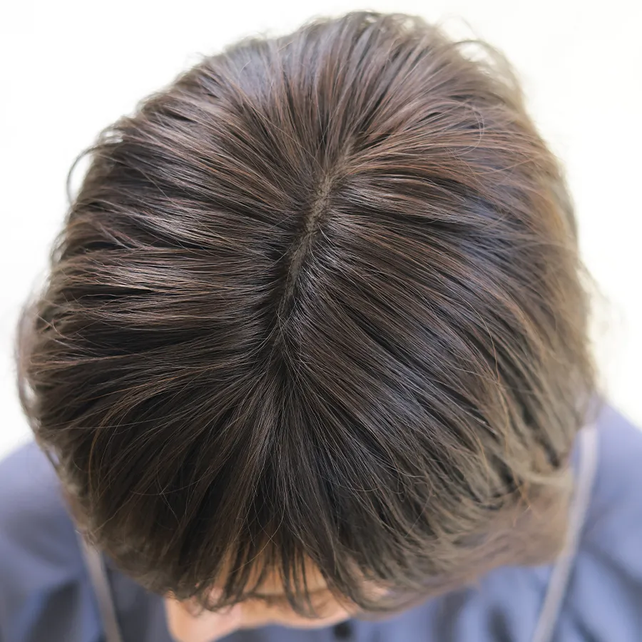 医療用ウィッグ ストーリーのリアルな分け目と自然なつむじ
